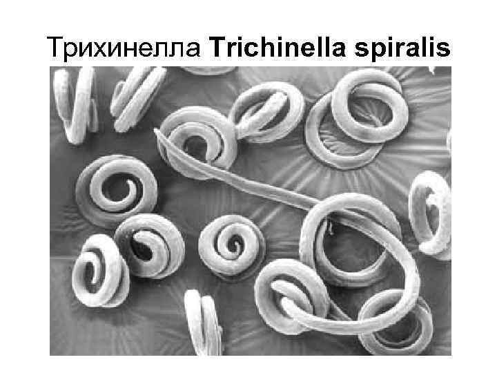 Трихинелла Trichinella spiralis 