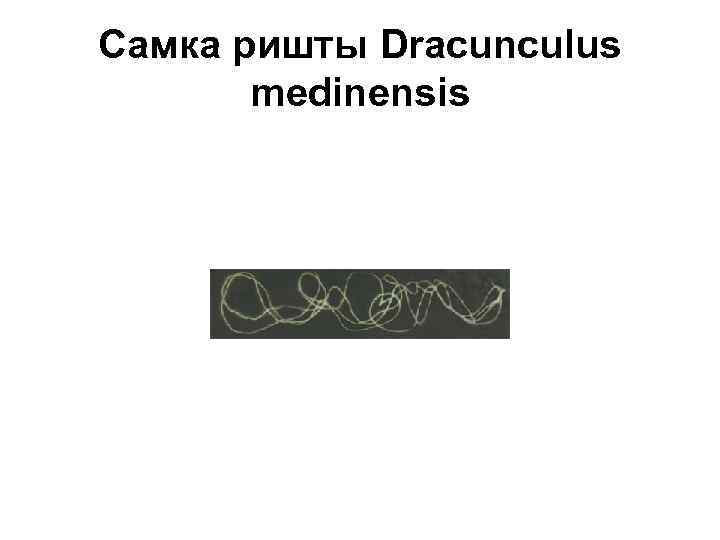 Самка ришты Dracunculus medinensis 