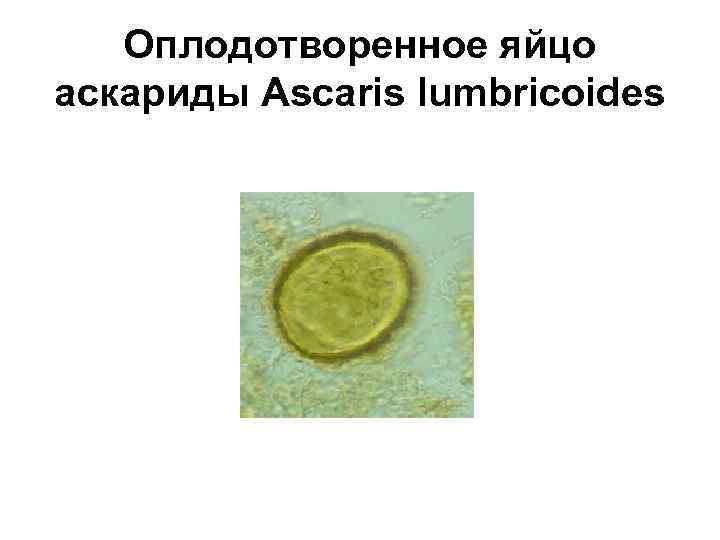 Оплодотворенное яйцо аскариды Ascaris lumbricoides 