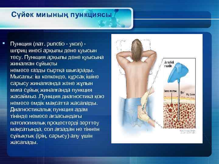 Сүйек миының пункциясы § Пункция (лат. punctio - укол) - шприц инесі арқылы дене
