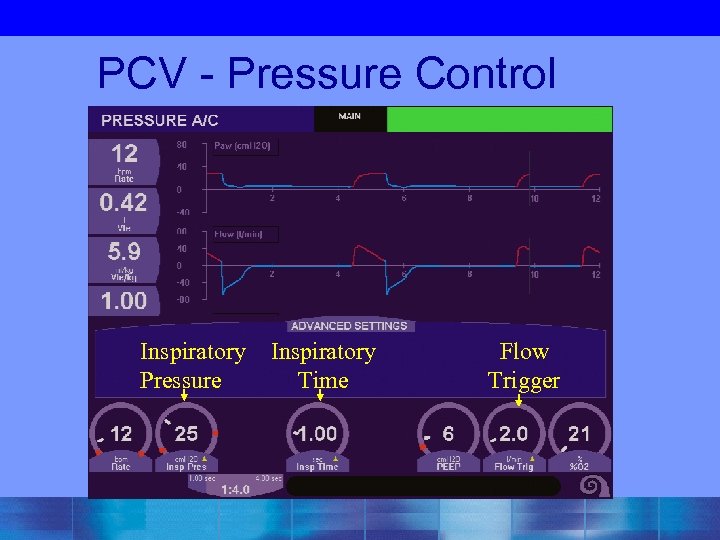 PCV - Pressure Control Inspiratory Pressure Inspiratory Time Flow Trigger 