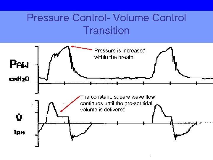 Pressure Control- Volume Control Transition Pressure is increased within the breath The constant, square