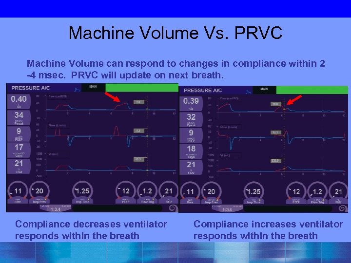 Machine Volume Vs. PRVC Machine Volume can respond to changes in compliance within 2