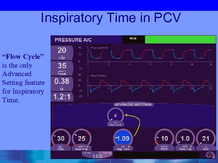  Inspiratory Time in PCV “Flow Cycle” is the only Advanced Setting feature for