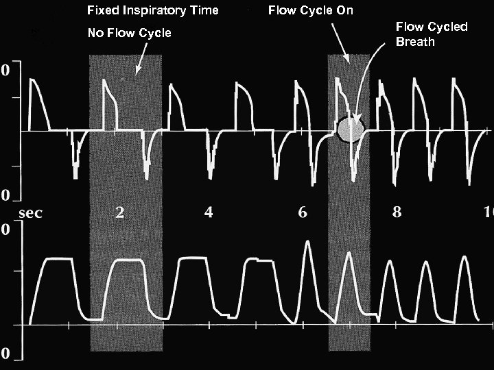 Fixed Inspiratory Time No Flow Cycle On Flow Cycled Breath 