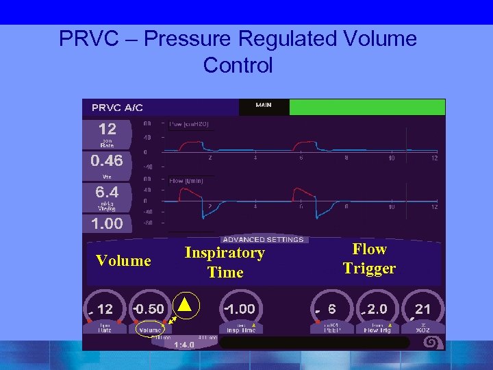 PRVC – Pressure Regulated Volume Control Volume Inspiratory Time Flow Trigger 