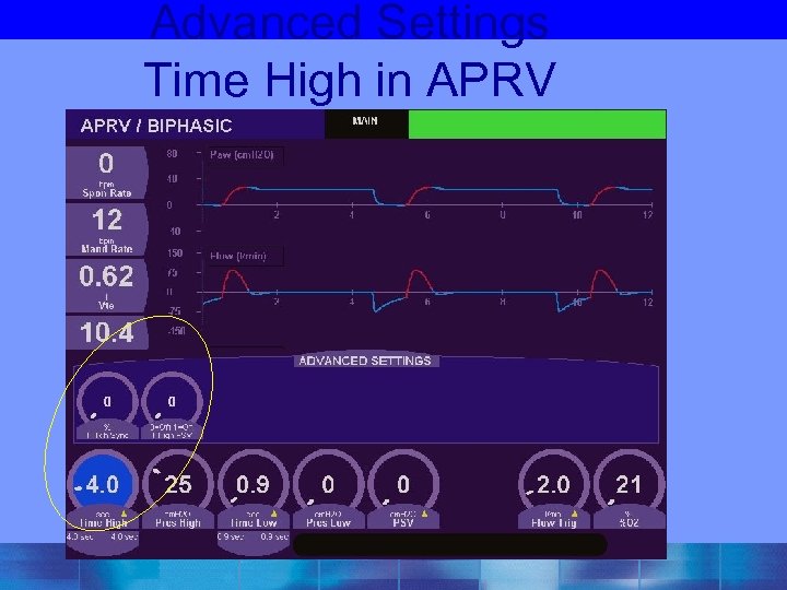 Advanced Settings Time High in APRV 