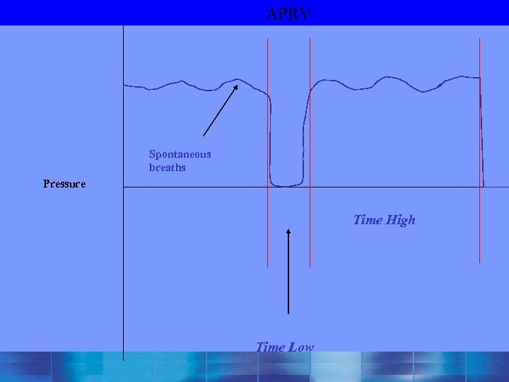 APRV Spontaneous breaths Pressure Time High Time Low 