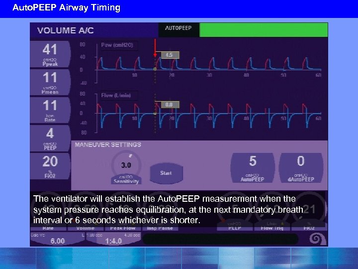 Auto. PEEP Airway Timing The ventilator will establish the Auto. PEEP measurement when the