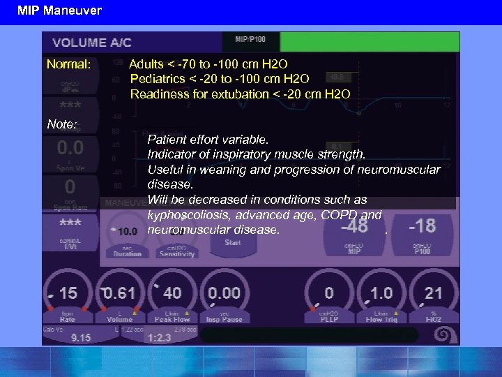 MIP Maneuver Normal: Adults < -70 to -100 cm H 2 O Pediatrics <