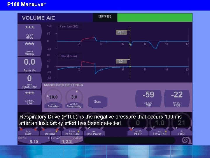 P 100 Maneuver Respiratory Drive (P 100), is the negative pressure that occurs 100