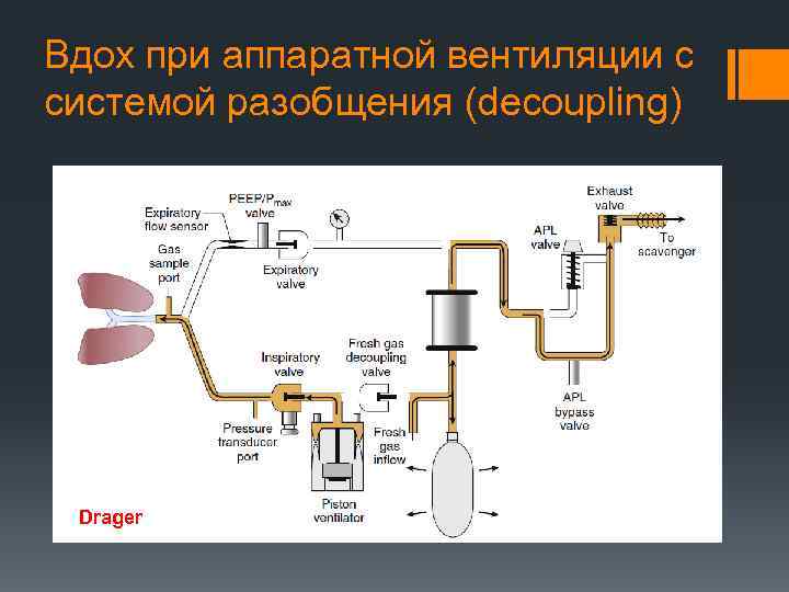 Вдох при аппаратной вентиляции с системой разобщения (decoupling) Drager 