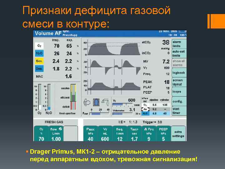 Признаки дефицита газовой смеси в контуре: § Drager Primus, МК 1 -2 – отрицательное