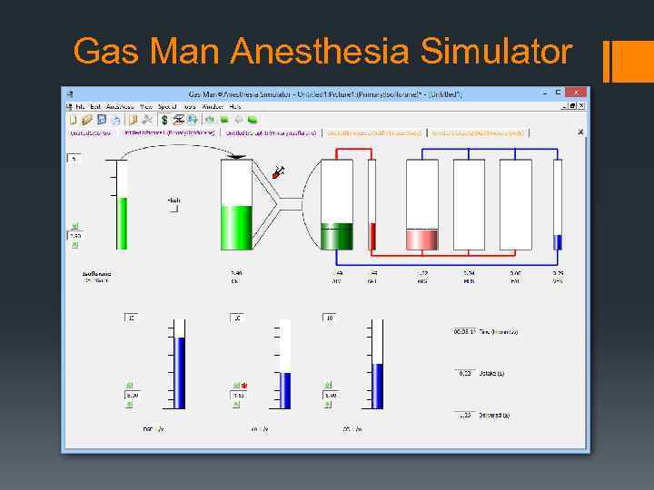 Gas Man Anesthesia Simulator 