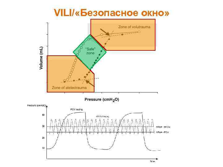 VILI/ «Безопасное окно» 