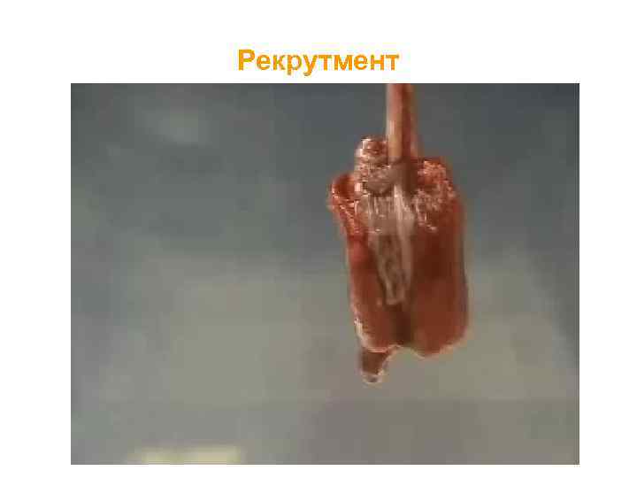 Рекрутмент 