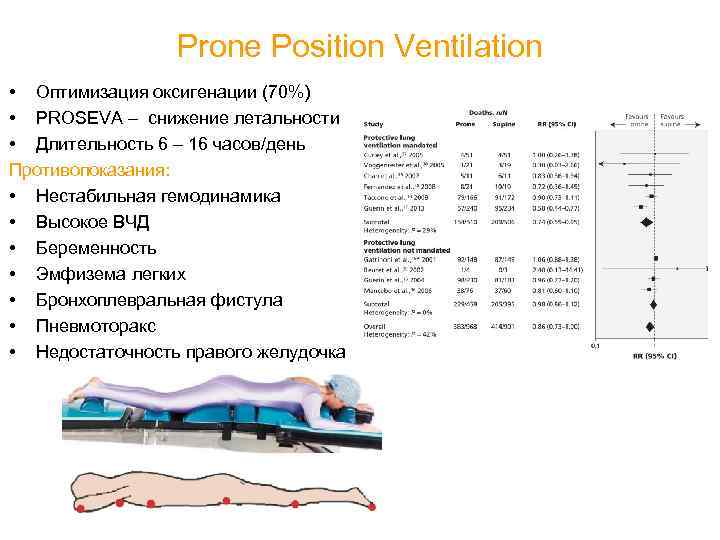Prone Position Ventilation • Оптимизация оксигенации (70%) • PROSEVA – снижение летальности • Длительность