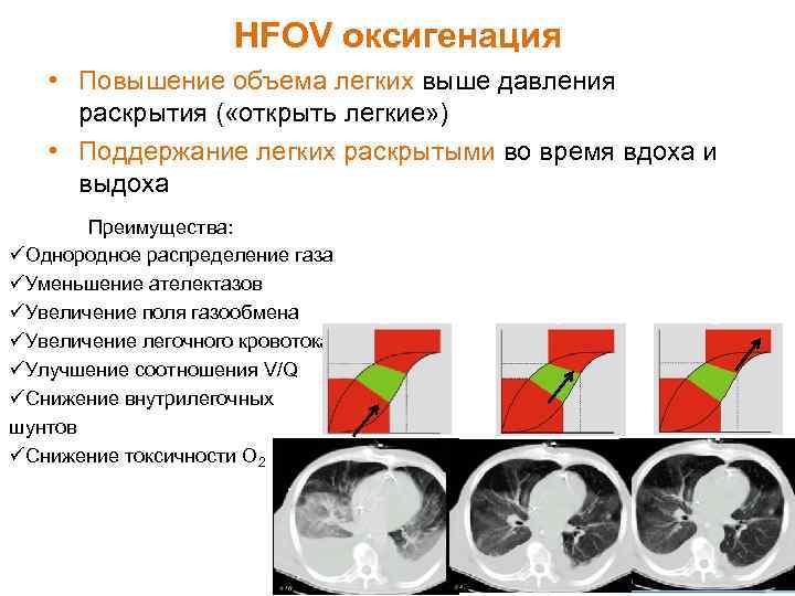 HFOV оксигенация • Повышение объема легких выше давления раскрытия ( «открыть легкие» ) •