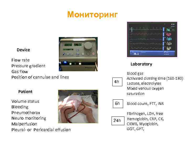 Мониторинг Device Flow rate Pressure gradient Gas flow Position of cannulae and lines Laboratory