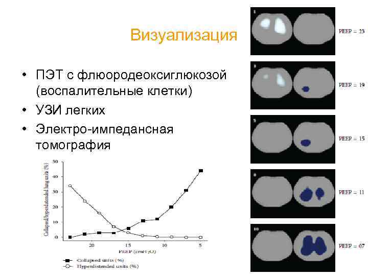 Визуализация • ПЭТ с флюородеоксиглюкозой (воспалительные клетки) • УЗИ легких • Электро-импедансная томография 
