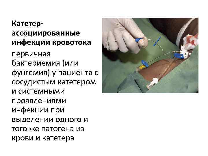 Катетерассоциированные инфекции кровотока первичная бактериемия (или фунгемия) у пациента с сосудистым катетером и системными