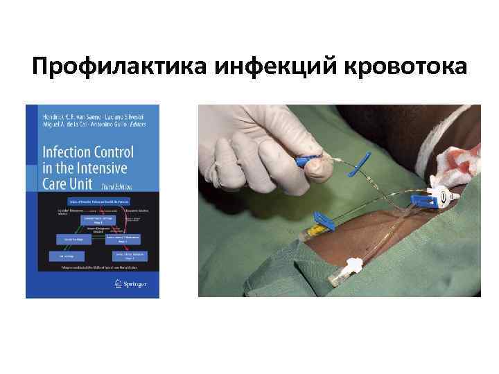 Профилактика инфекций кровотока 