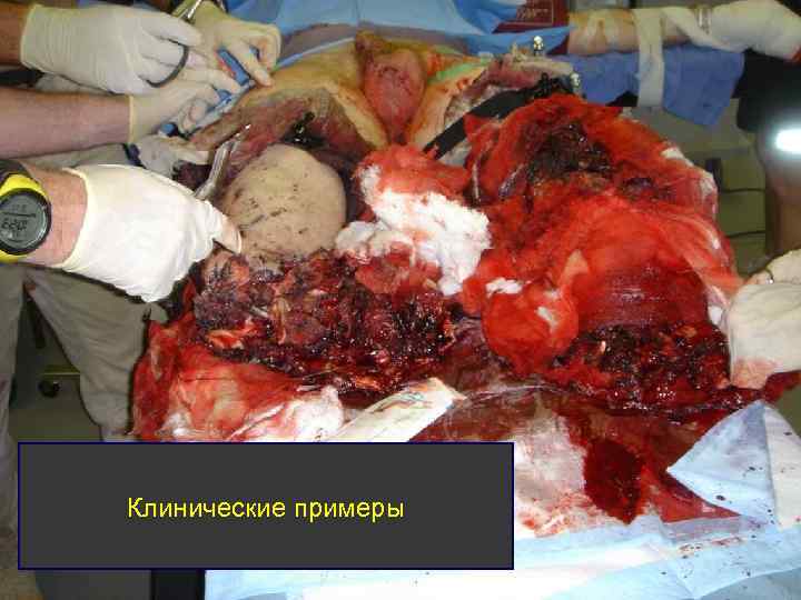 Клинические примеры 