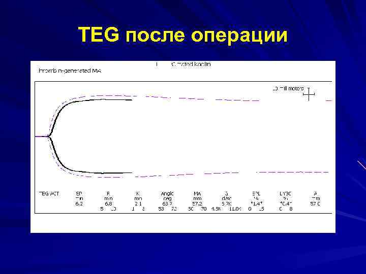TEG после операции 