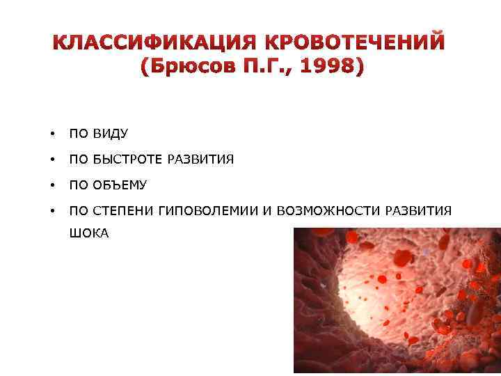 КЛАССИФИКАЦИЯ КРОВОТЕЧЕНИЙ (Брюсов П. Г. , 1998) • ПО ВИДУ • ПО БЫСТРОТЕ РАЗВИТИЯ