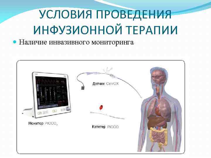 УСЛОВИЯ ПРОВЕДЕНИЯ ИНФУЗИОННОЙ ТЕРАПИИ Наличие инвазивного мониторинга 