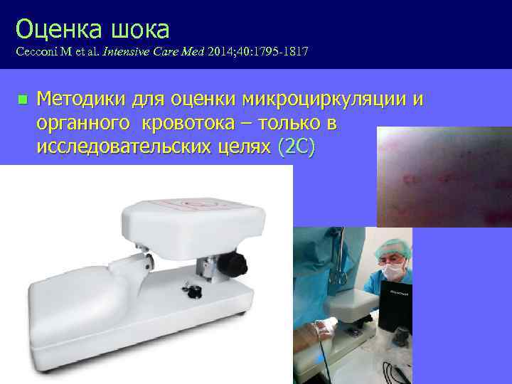 Оценка шока Cecconi M et al. Intensive Care Med 2014; 40: 1795 -1817 n