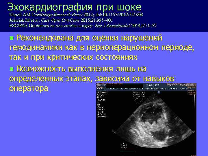 Эхокардиография при шоке Napoli AM Cardiology Research Pract 2012; doi: 10. 1155/2012/531908 Jozwiak M