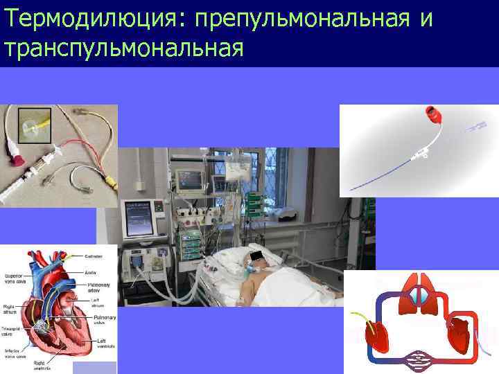 Термодилюция: препульмональная и транспульмональная 