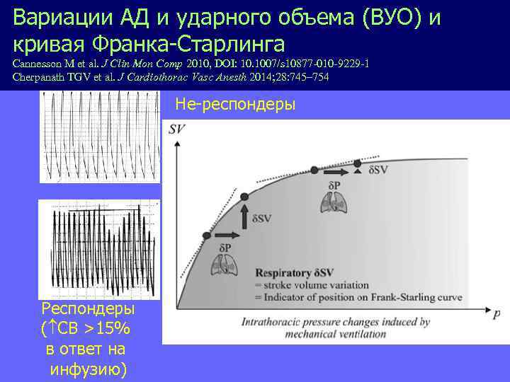 Вариации АД и ударного объема (ВУО) и кривая Франка-Старлинга Сannesson M et al. J