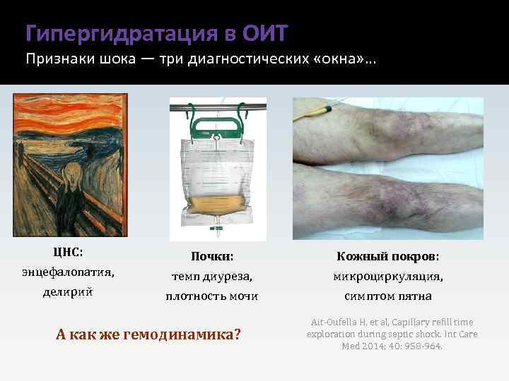Гипергидратация в ОИТ Признаки шока — три диагностических «окна» … ЦНС: Почки: Кожный покров: