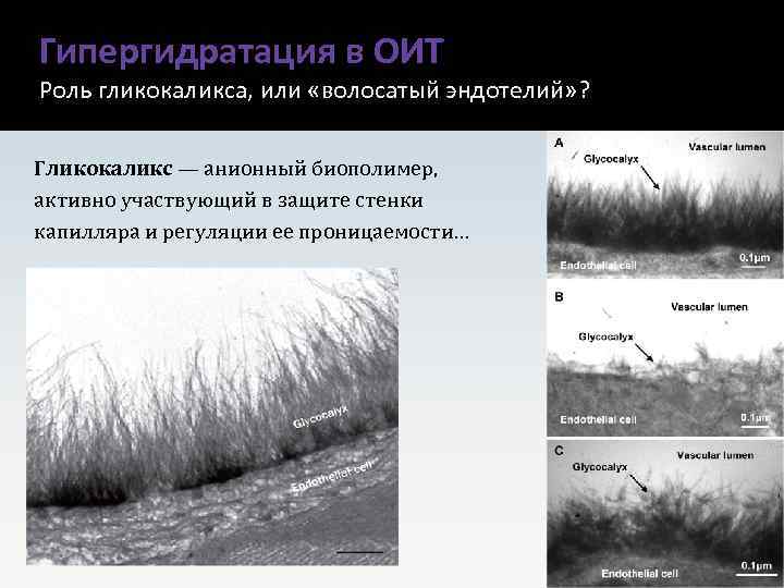 Гипергидратация в ОИТ Роль гликокаликса, или «волосатый эндотелий» ? Гликокаликс — анионный биополимер, активно