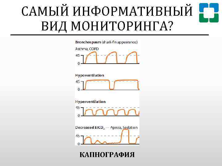 САМЫЙ ИНФОРМАТИВНЫЙ ВИД МОНИТОРИНГА? КАПНОГРАФИЯ 