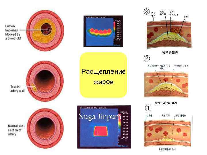Расщепление жиров Nuga Jinpum 