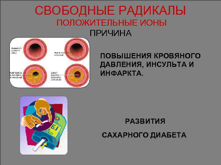 СВОБОДНЫЕ РАДИКАЛЫ ПОЛОЖИТЕЛЬНЫЕ ИОНЫ ПРИЧИНА ПОВЫШЕНИЯ КРОВЯНОГО ДАВЛЕНИЯ, ИНСУЛЬТА И ИНФАРКТА. РАЗВИТИЯ САХАРНОГО ДИАБЕТА
