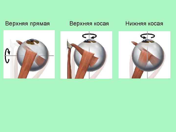 Верхняя прямая Верхняя косая Нижняя косая 