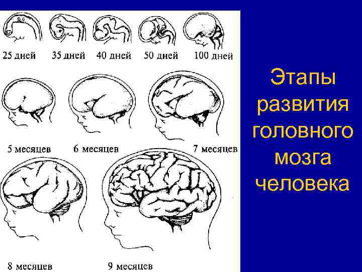 Картинки для развития мозга взрослого человека с ответами