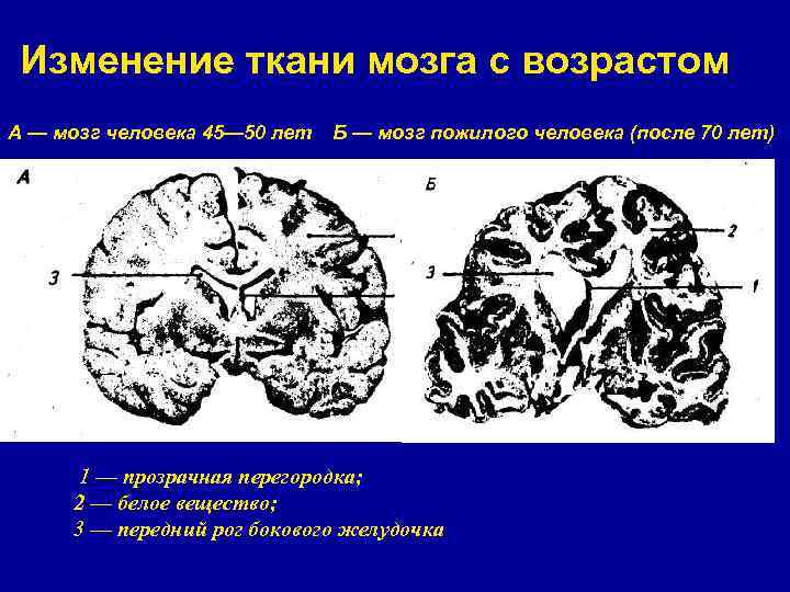 Возрастные изменения мозга. Изменение мозга человека. Мозг молодого и старого человека. Изменение головного мозга с возрастом.
