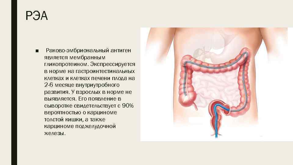 РЭА ■ Раково-эмбриональный антиген является мембранным гликопротеином. Экспрессируется в норме на гастроинтестинальных клетках и