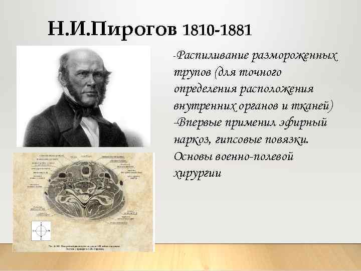 Н. И. Пирогов 1810 -1881 -Распиливание размороженных трупов (для точного определения расположения внутренних органов