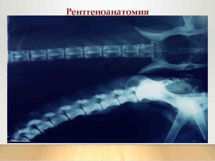 Рентгеноанатомия 