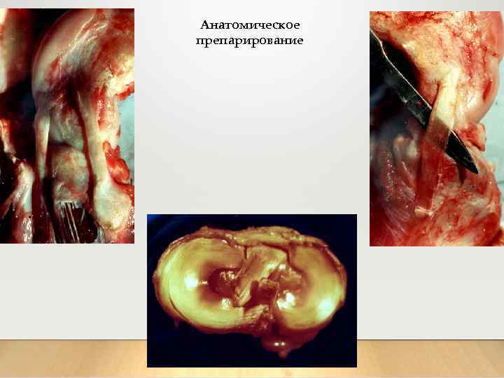 Анатомическое препарирование 