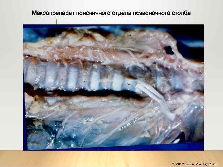 Макропрепарат поясничного отдела позвоночного столба МГАВМи. Б им. К. И. Скрябина 