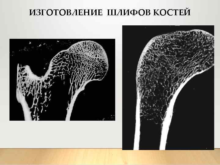 ИЗГОТОВЛЕНИЕ ШЛИФОВ КОСТЕЙ 