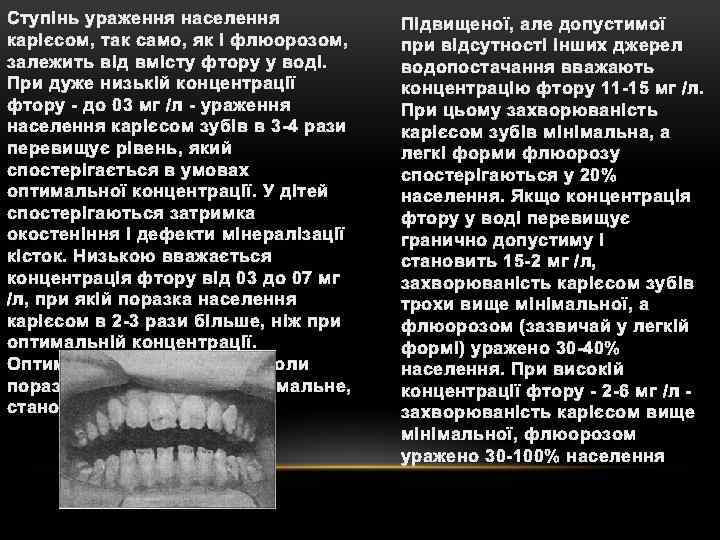 Ступінь ураження населення карієсом, так само, як і флюорозом, залежить від вмісту фтору у