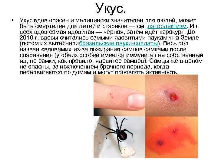 Укус. • Укус вдов опасен и медицински значителен для людей, может быть смертелен для